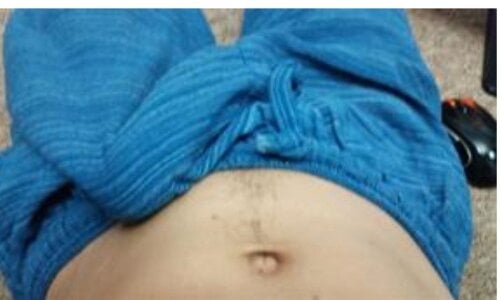 joyfullpussylicker Public Pic 4