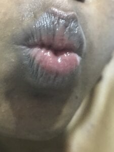 De_maskedcouple Smiley Pic