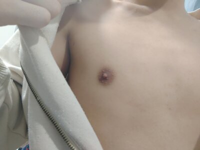 hinata_29 Public Pic 2