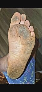 Feet😉 de solotoes Foto