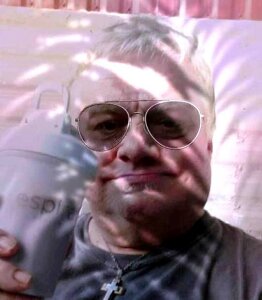 LooseSkin4U Weight Loss Journey  2. fénykép