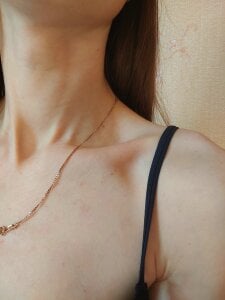 BellaBianco You like skinny girls ) ribs) mark like Pic 6