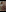 CandyShoopp: pussy close-up ( 2 фото)