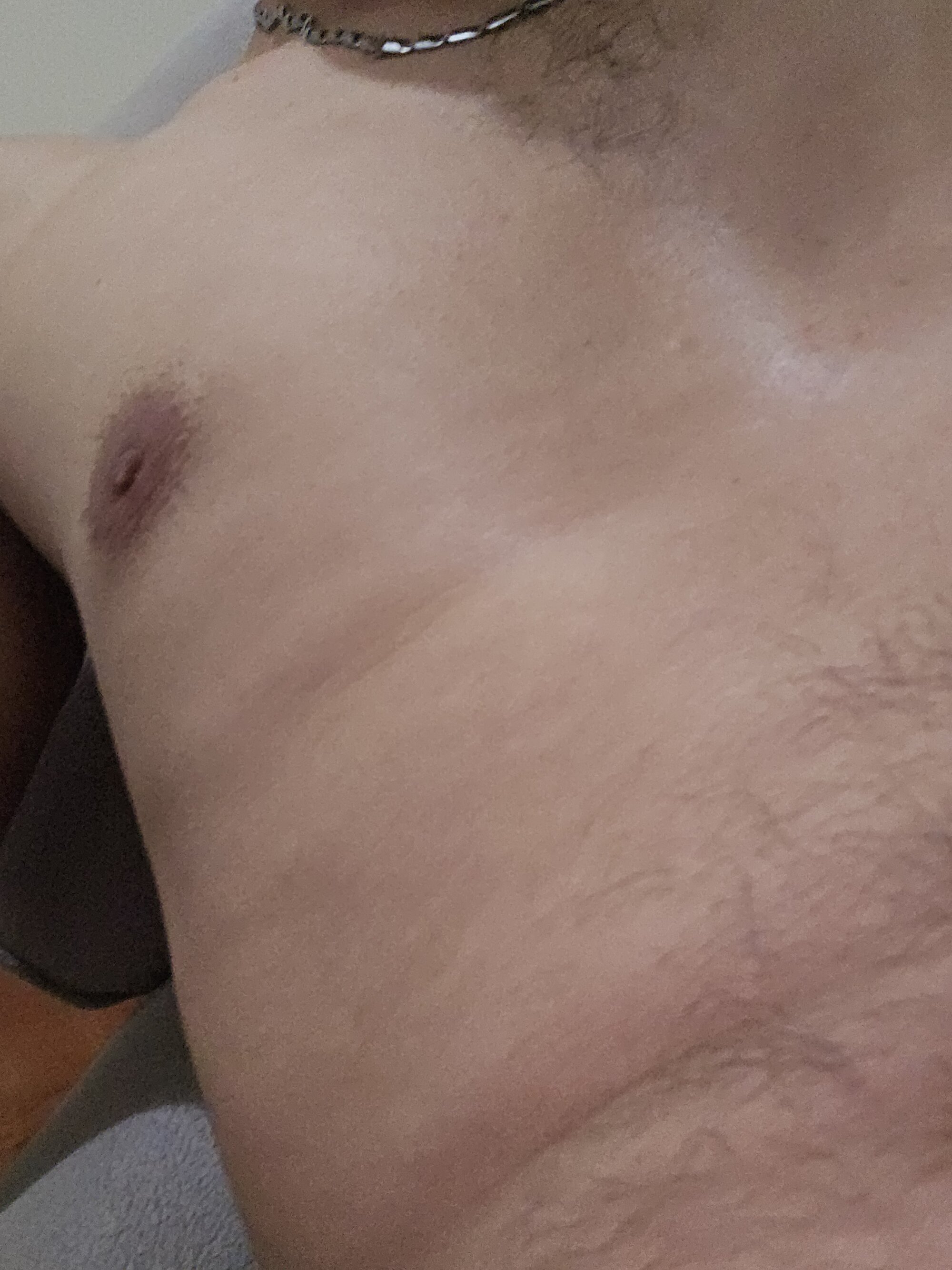 bypenis