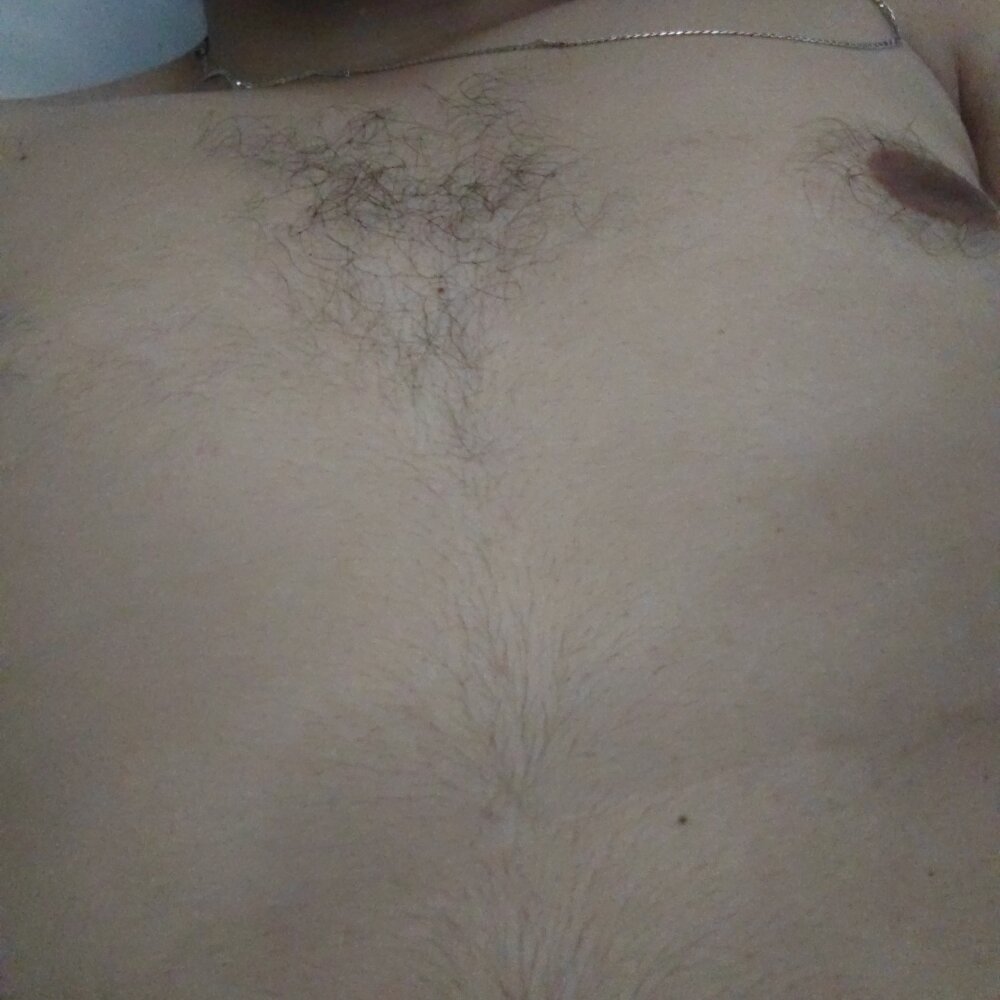 pestinha3