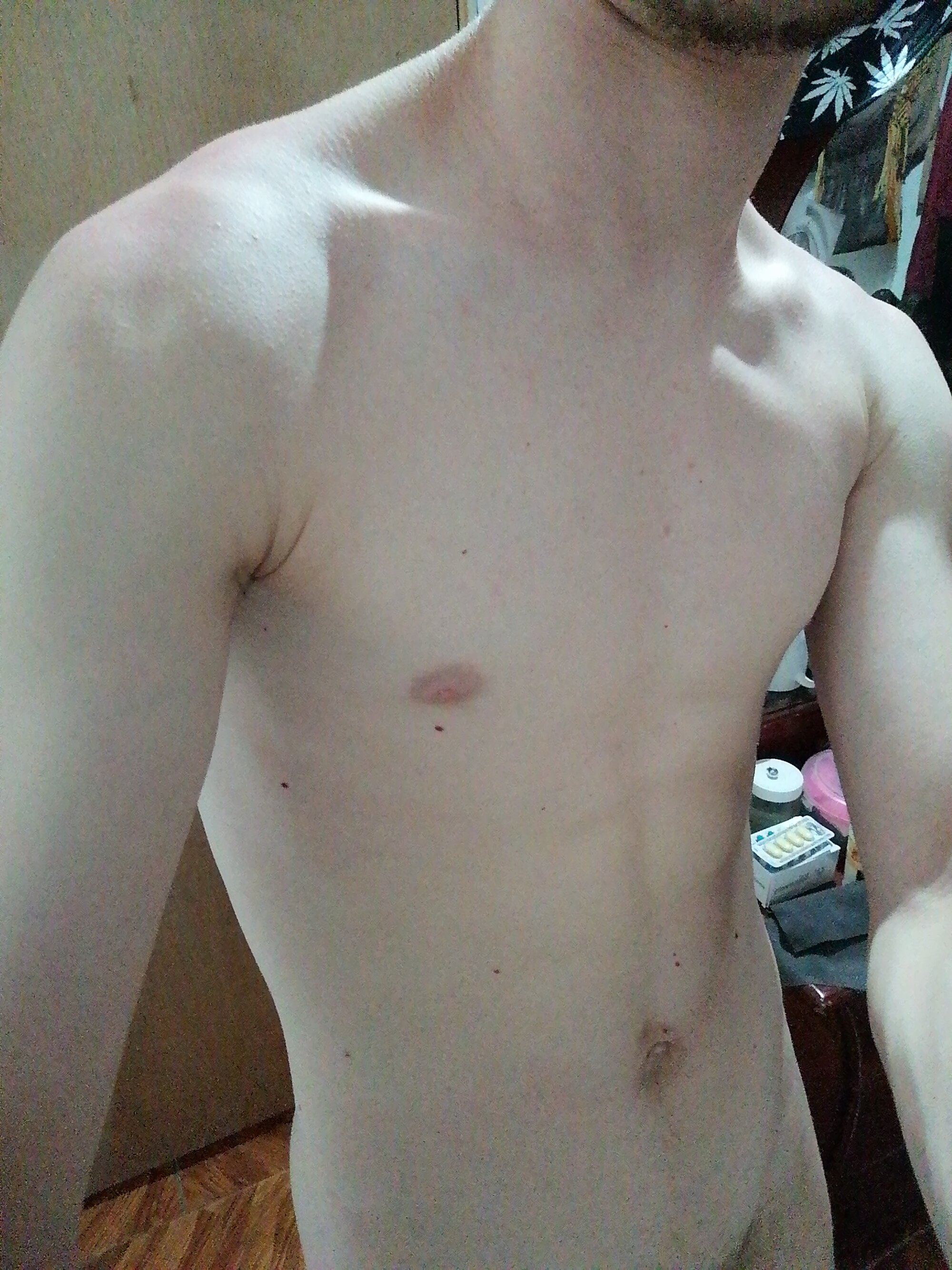 Adictoaculear99