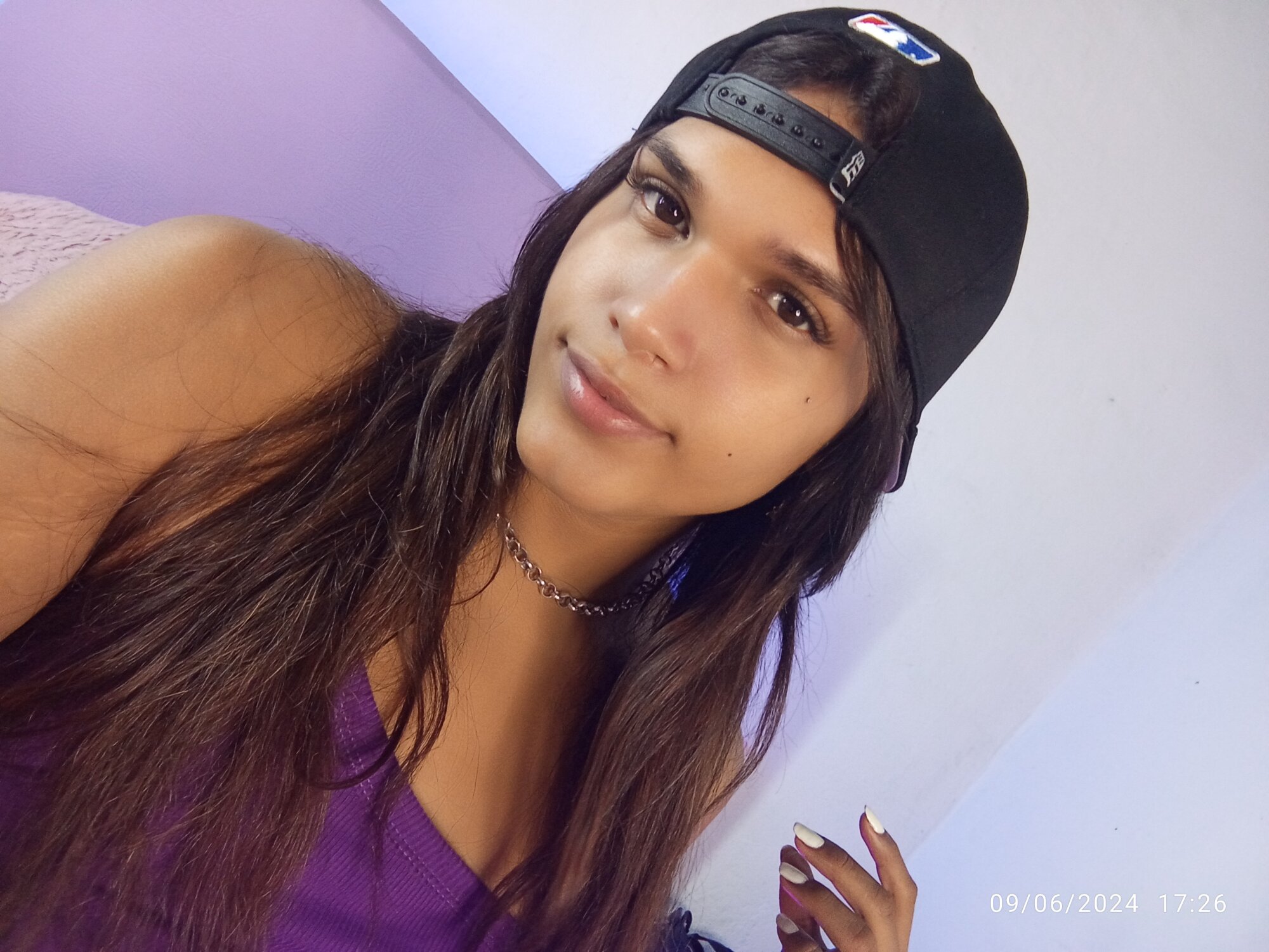 Nicole-anistom