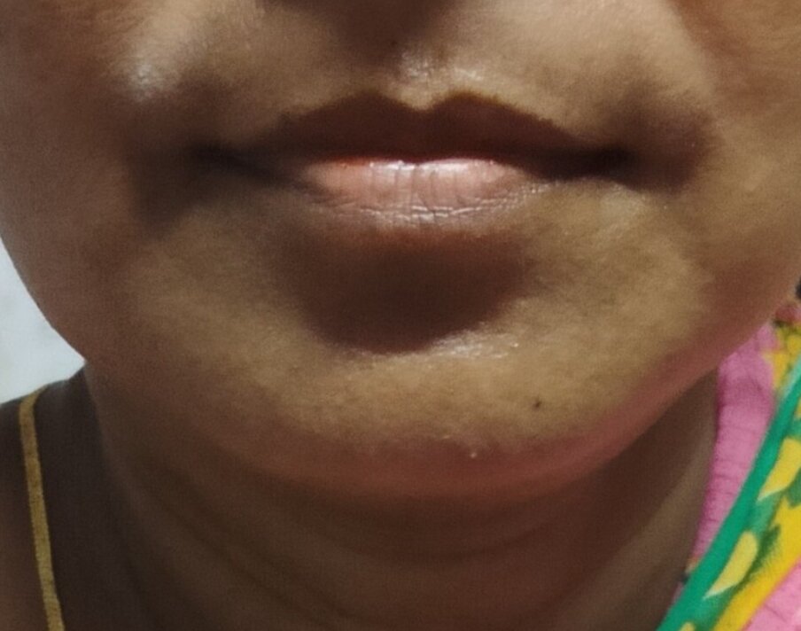 JlYA244