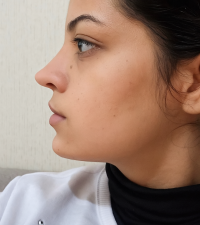 Profile