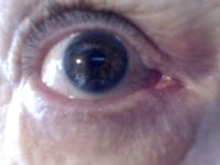 utilisasinus webcam thumbnail