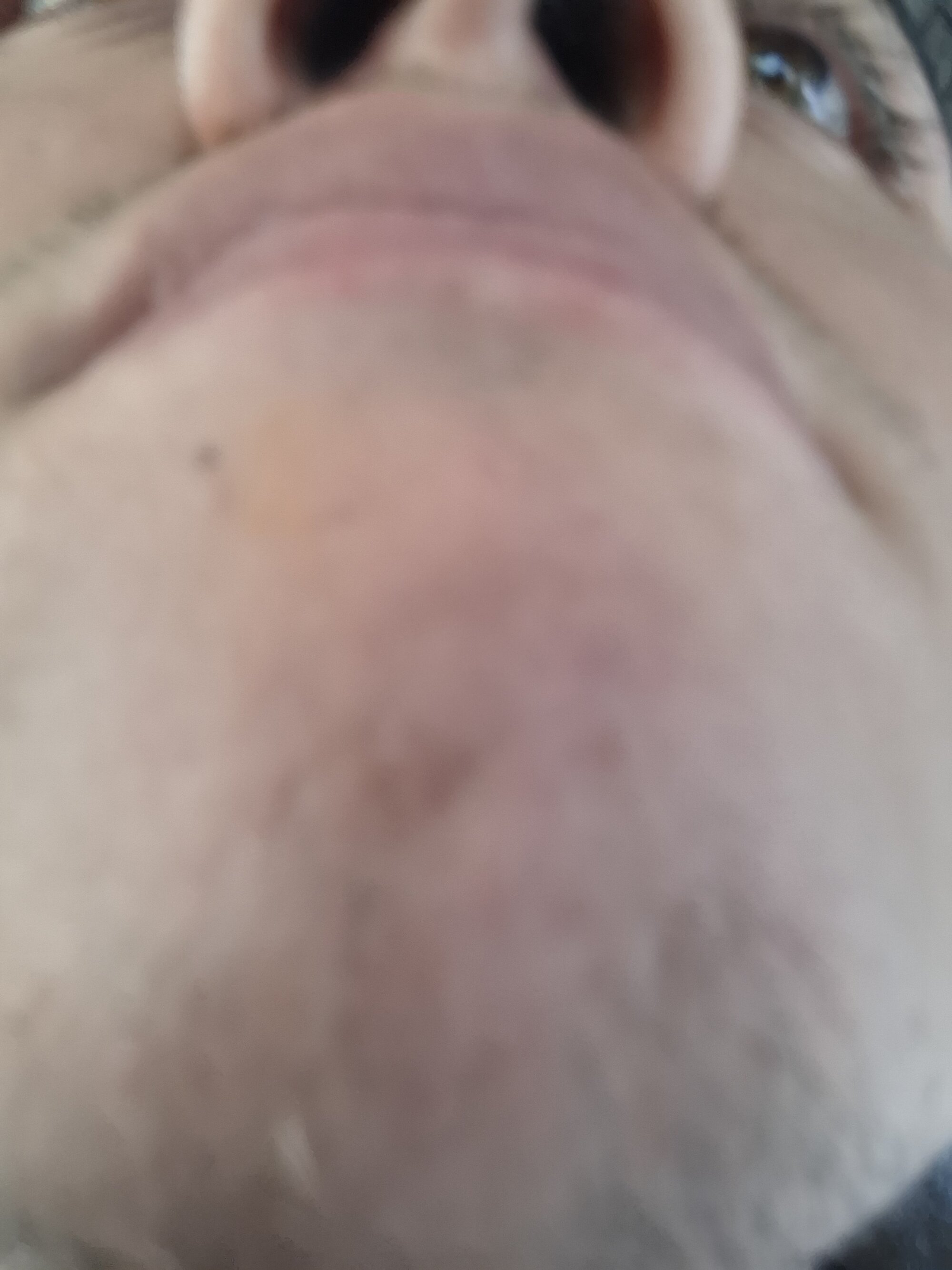 Remaluo