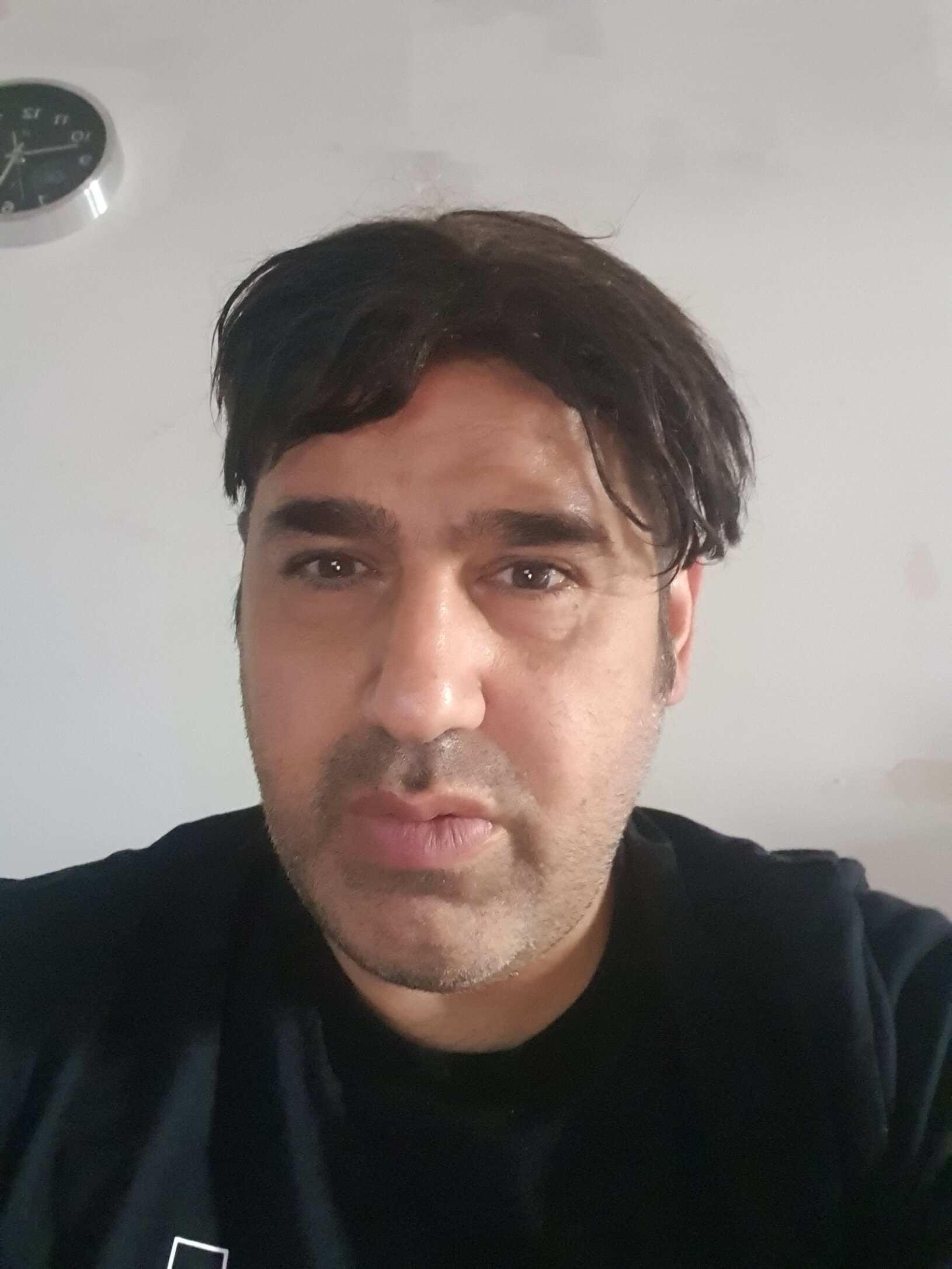 CORONALD live webcam