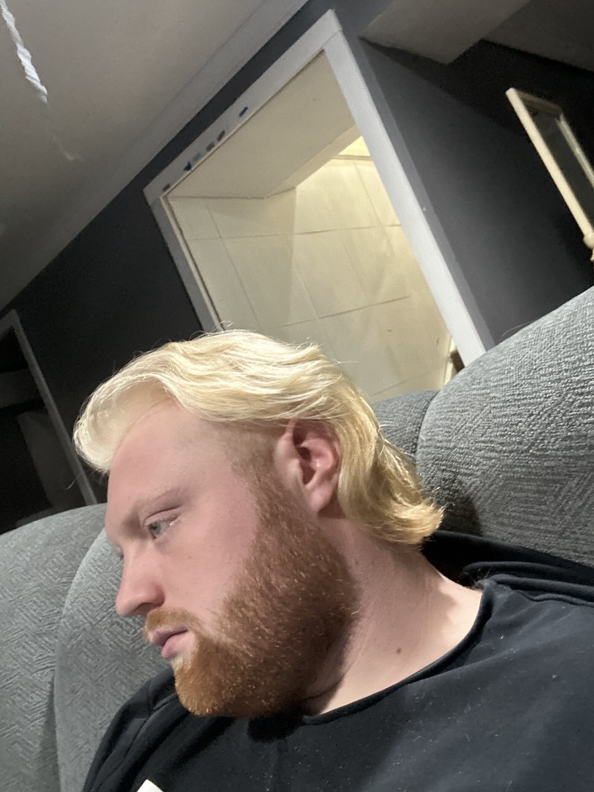 Albino_bruce97