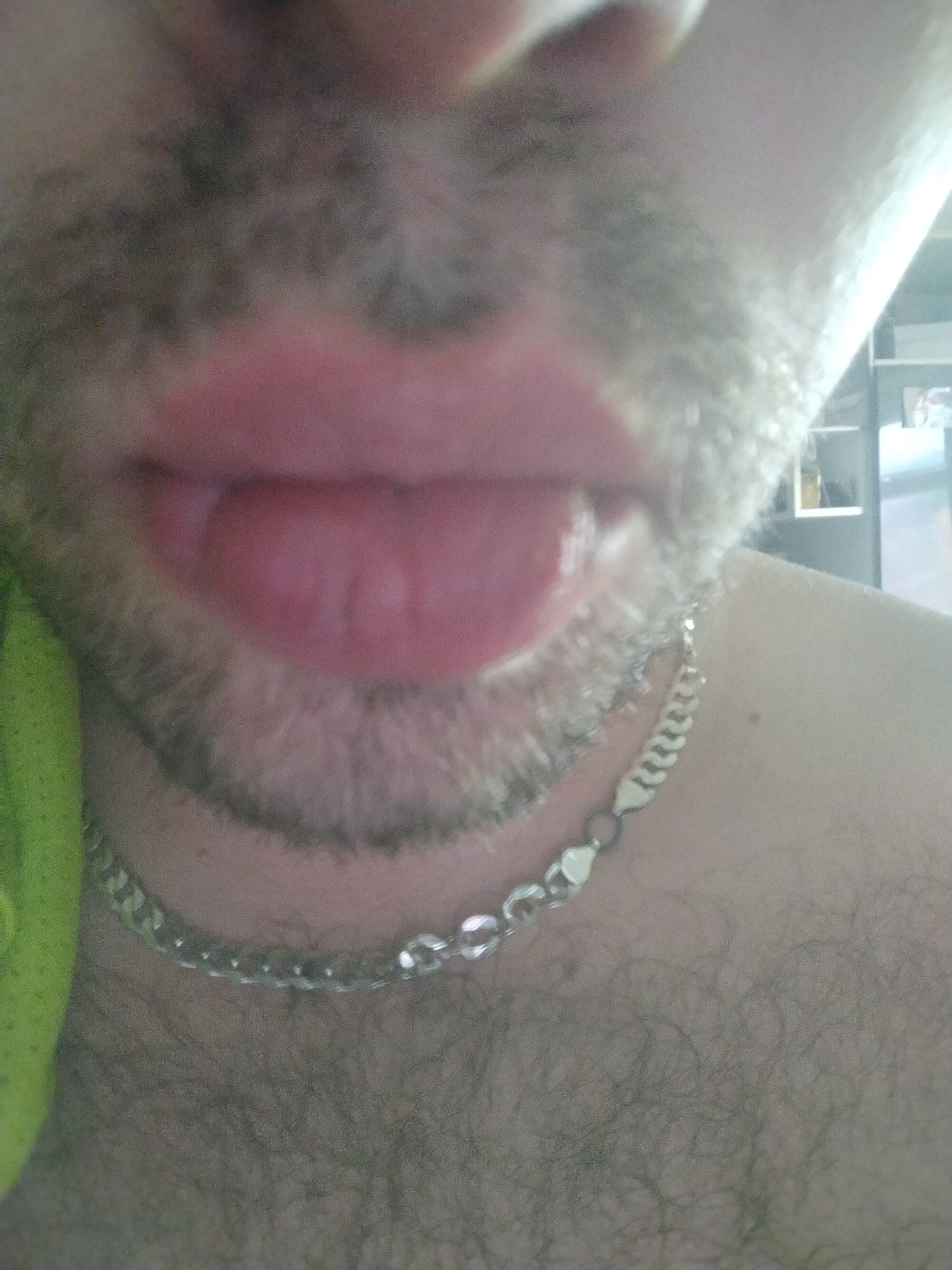 bilbatreex1