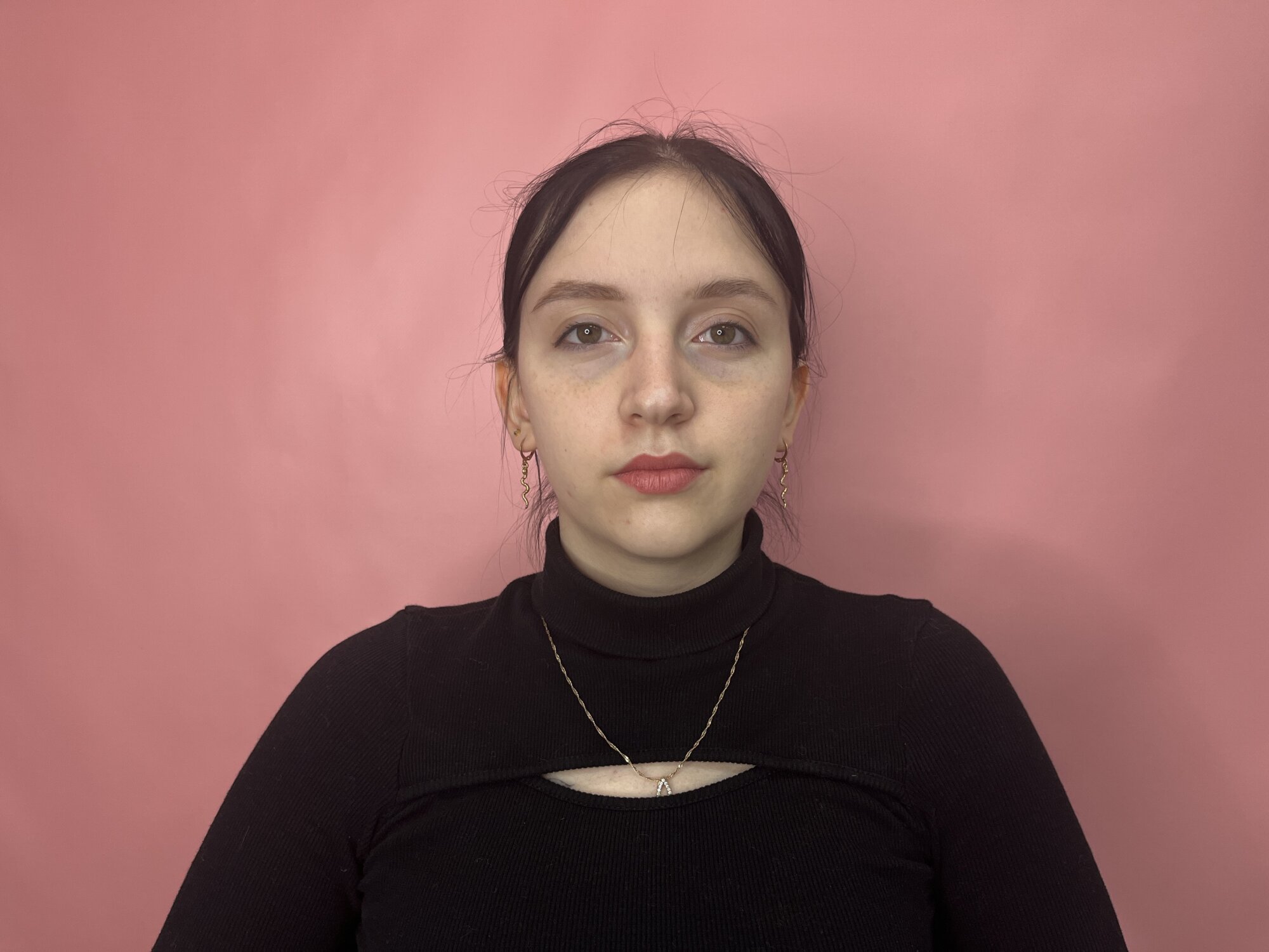 AmyDilox