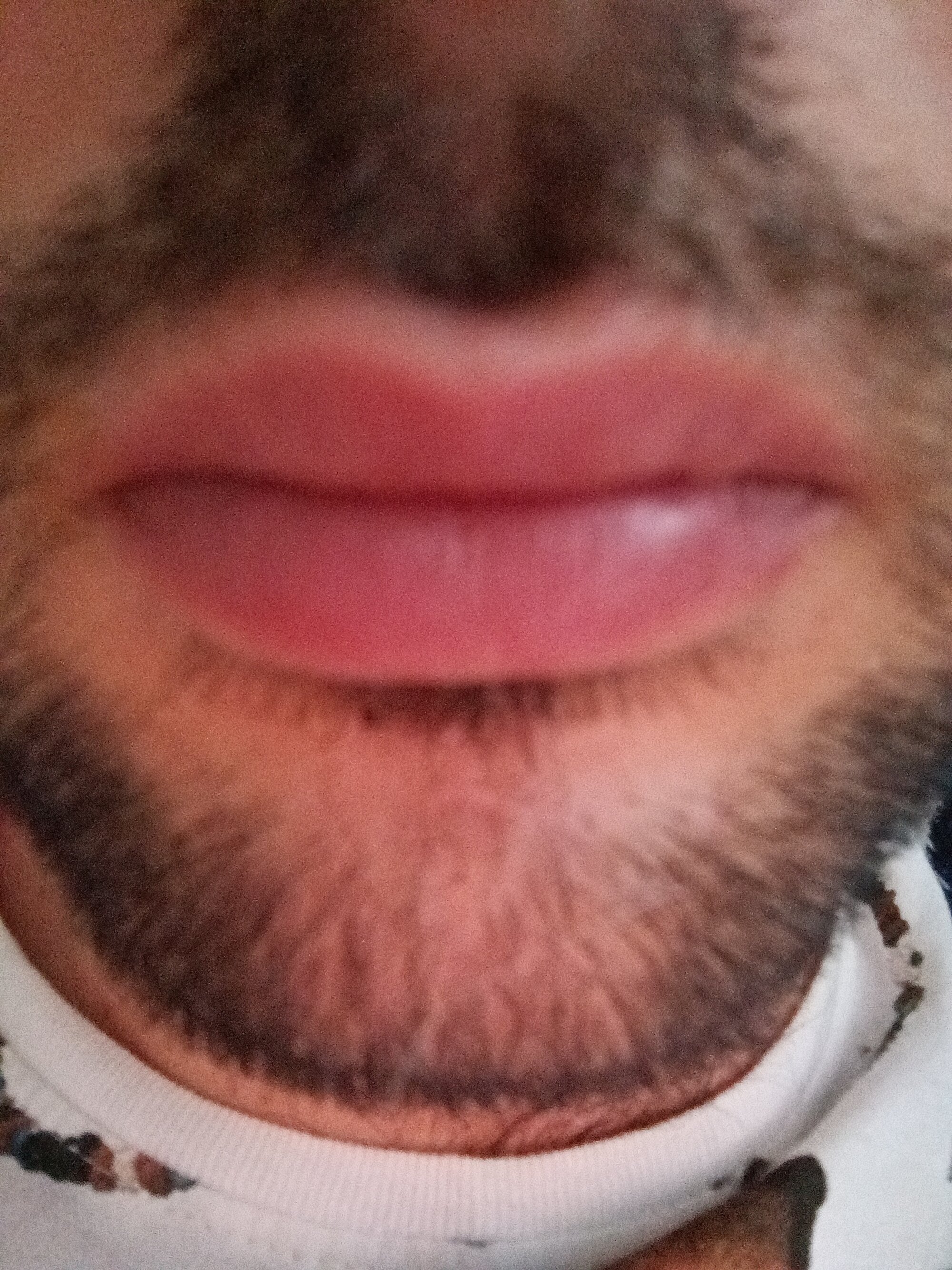 Galimocho