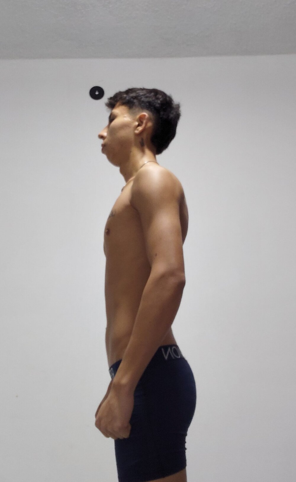 Flacoxlx profile