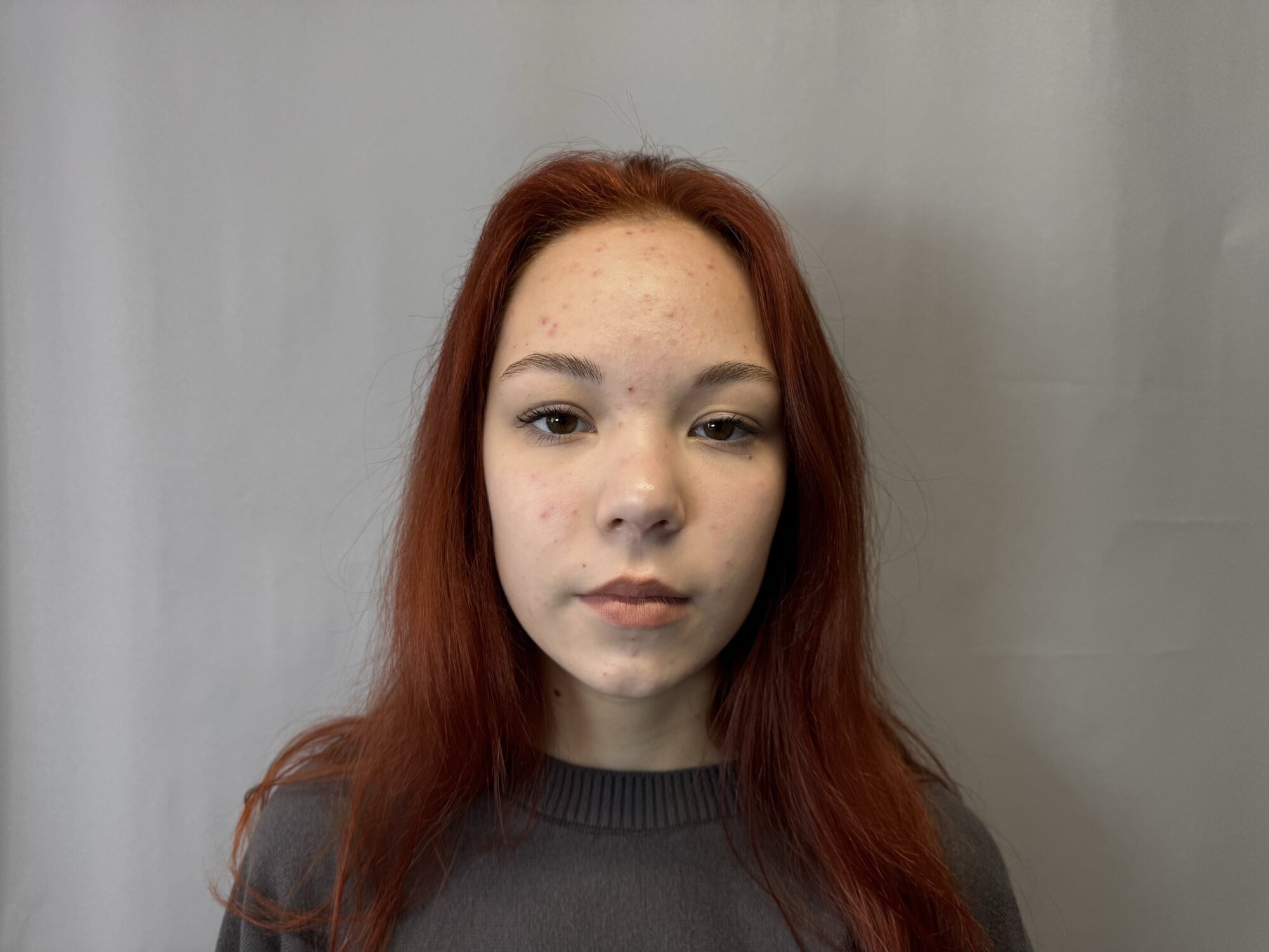 RexanneBayse