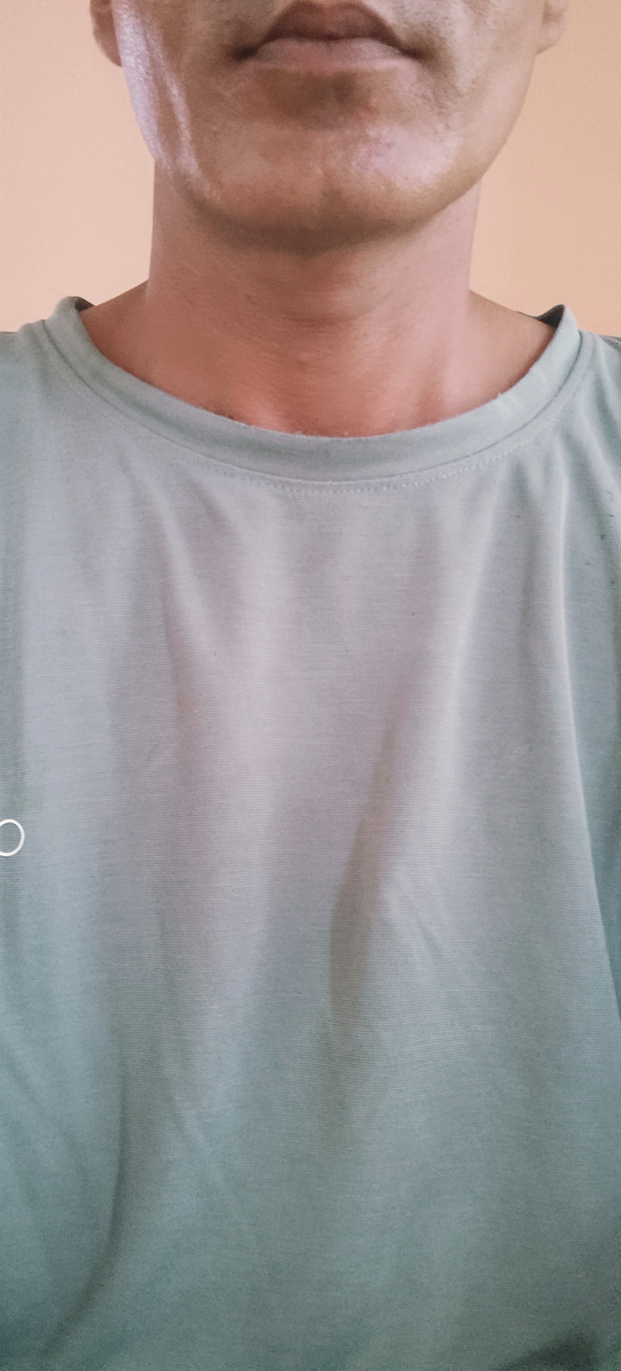 _HOT_SAM
