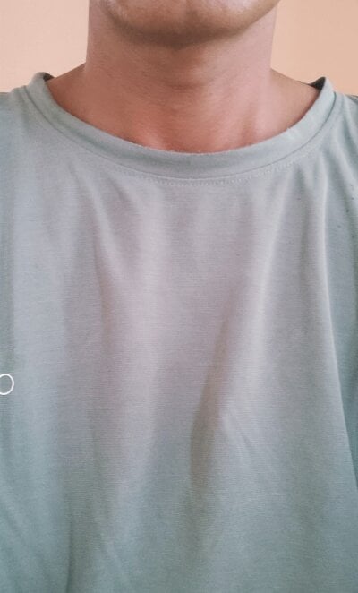 _HOT_SAM