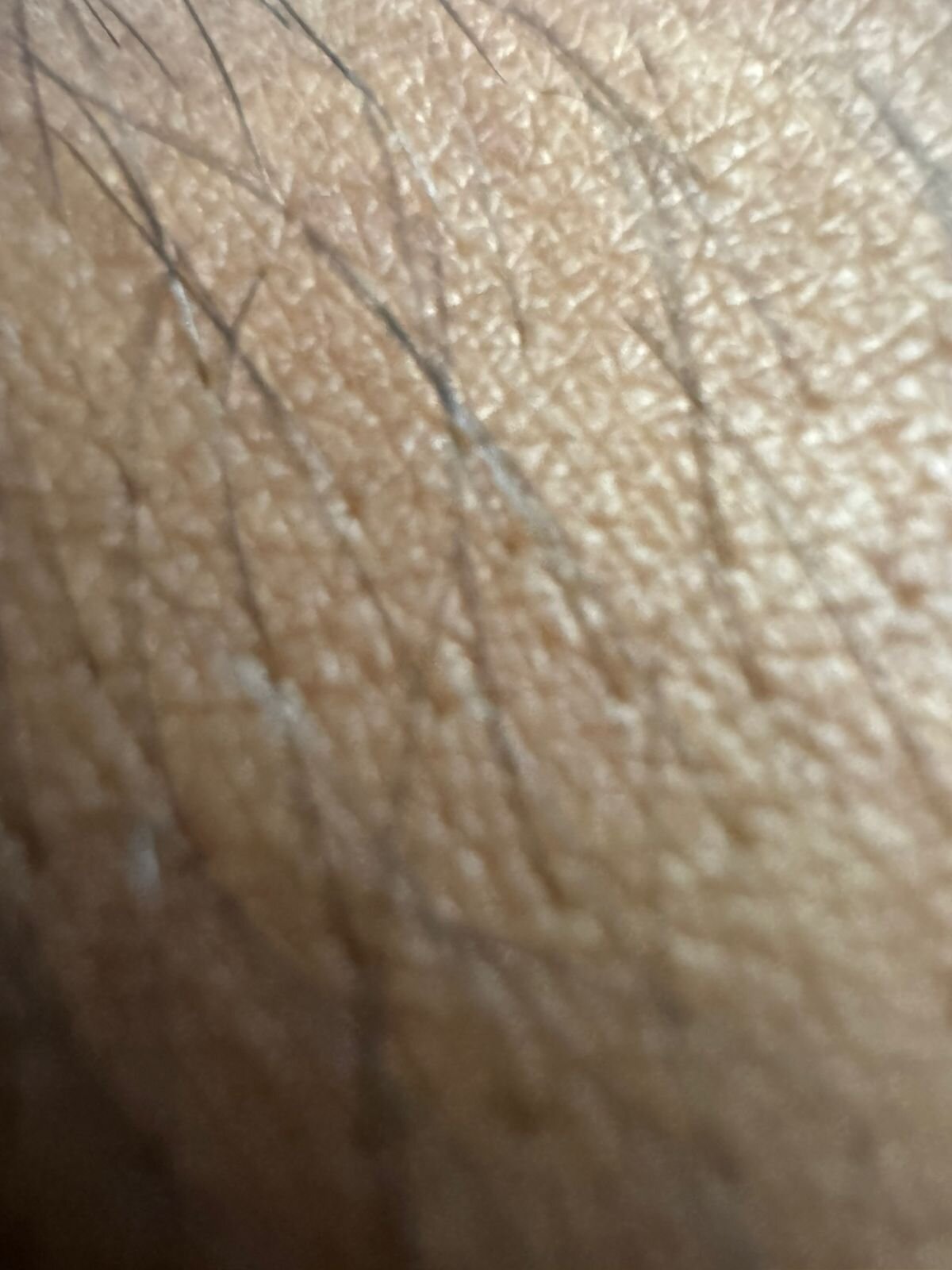 lxlx0101