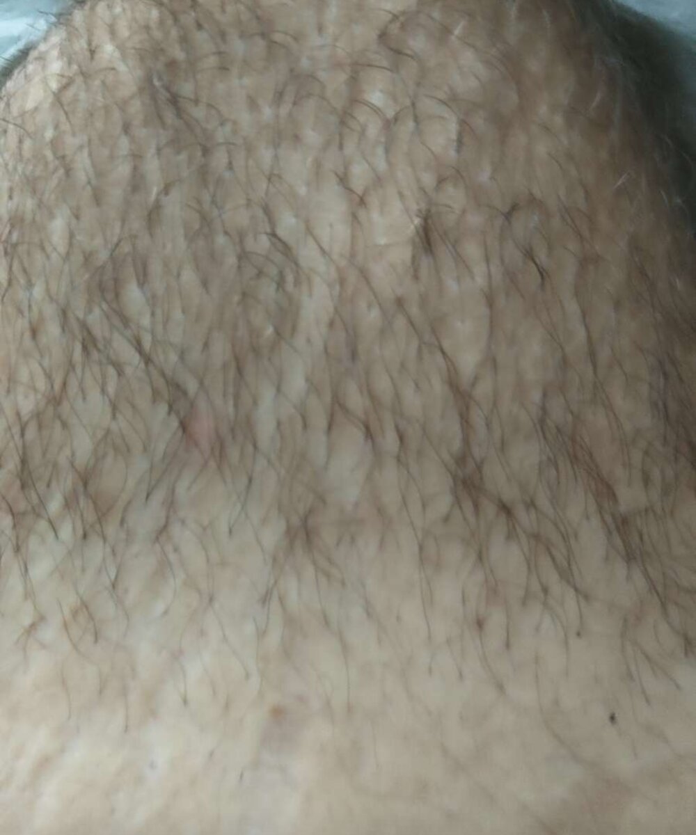 Slin1307
