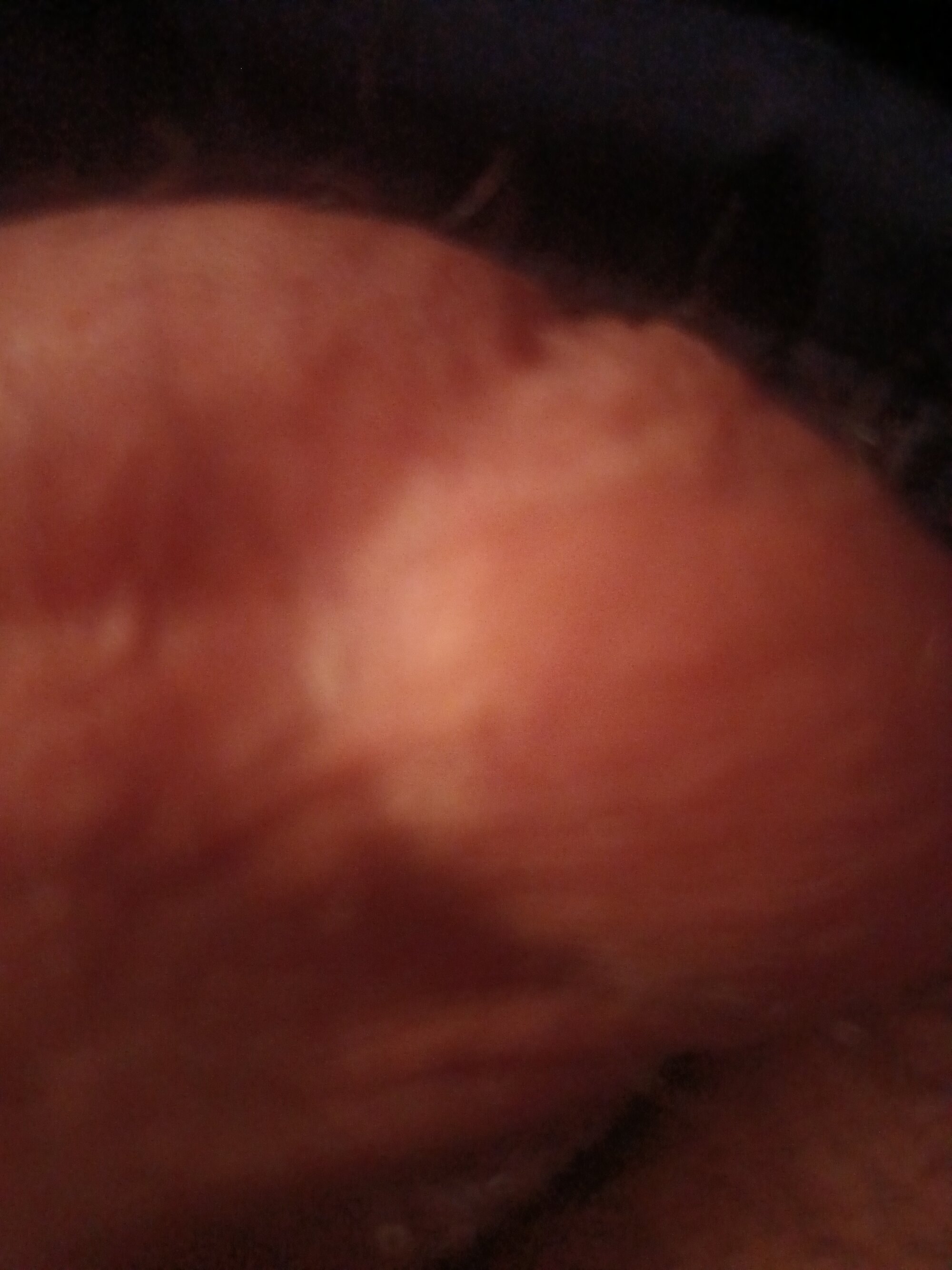 bymedon