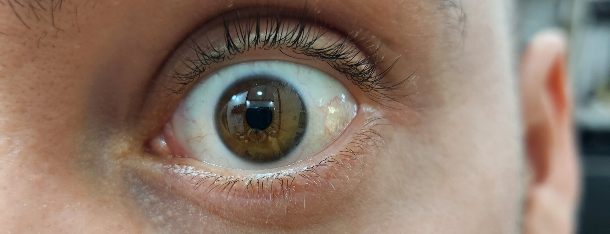 axel_ax4
