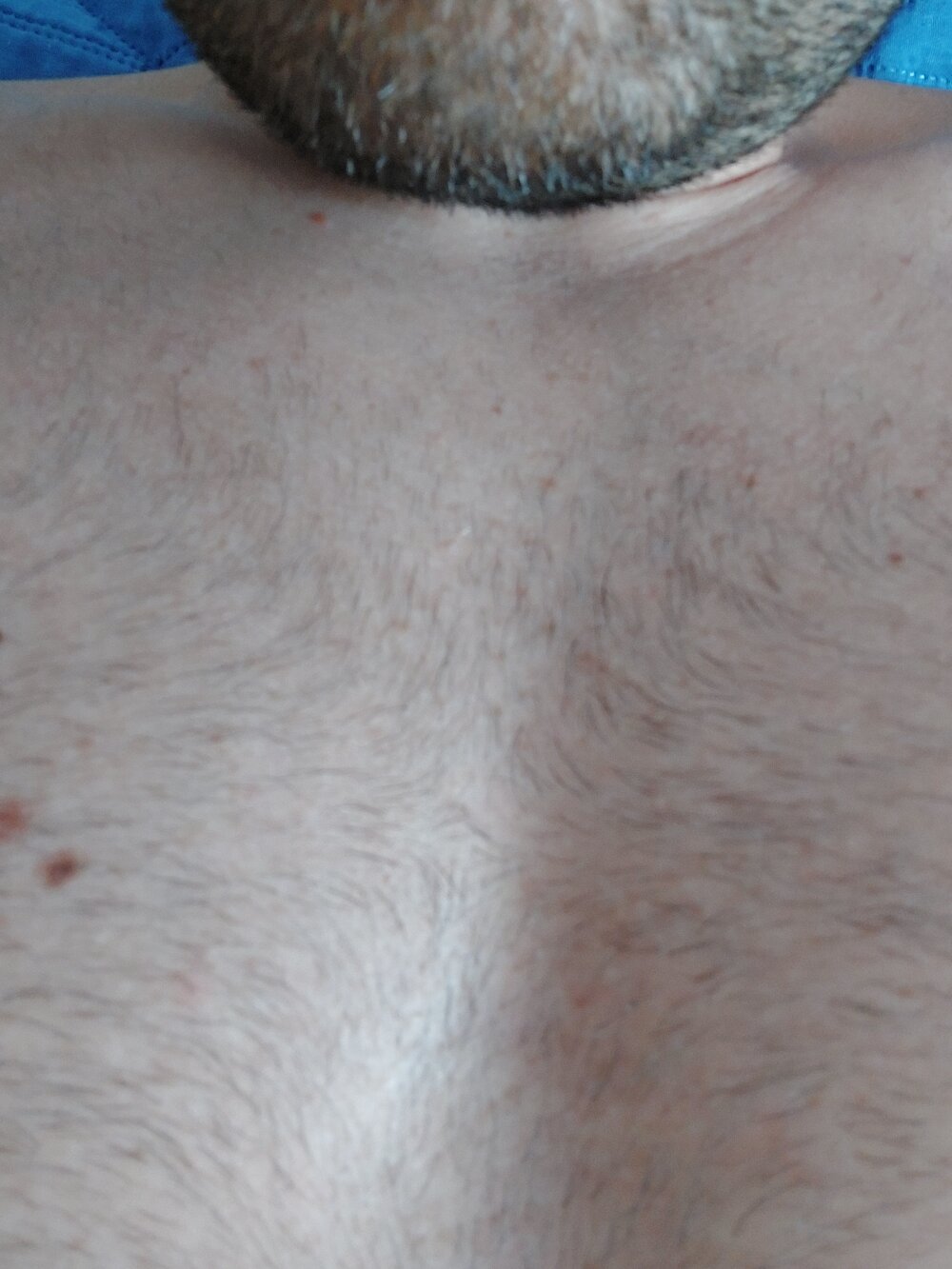 matlock1988 from stripchat
