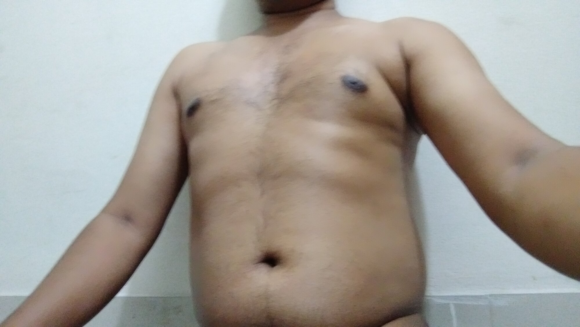 Nalam1774