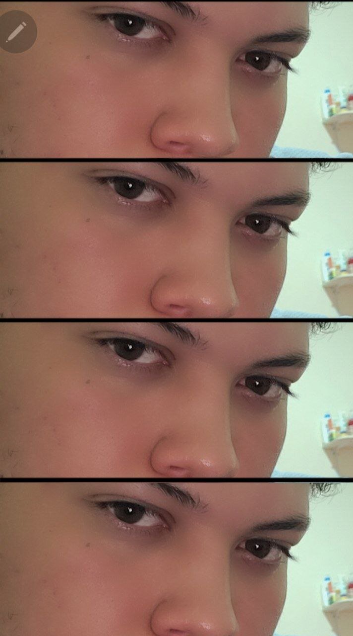 Albert_cas