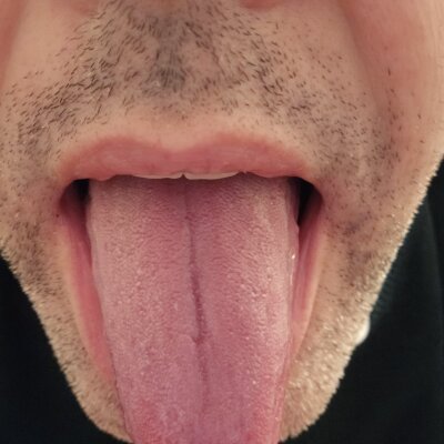 nymphoxman from stripchat