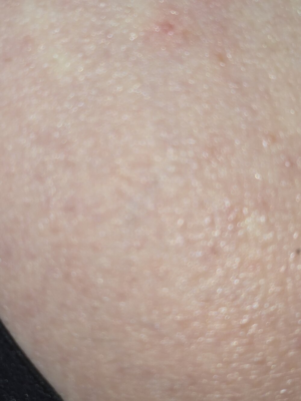 elpir00122 profile