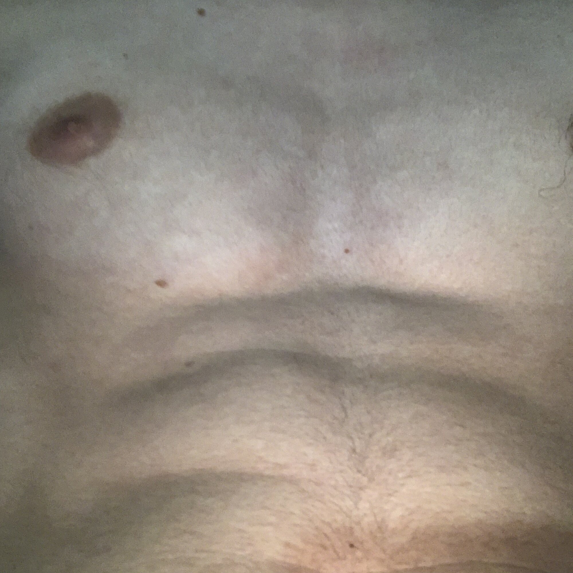 mm34974