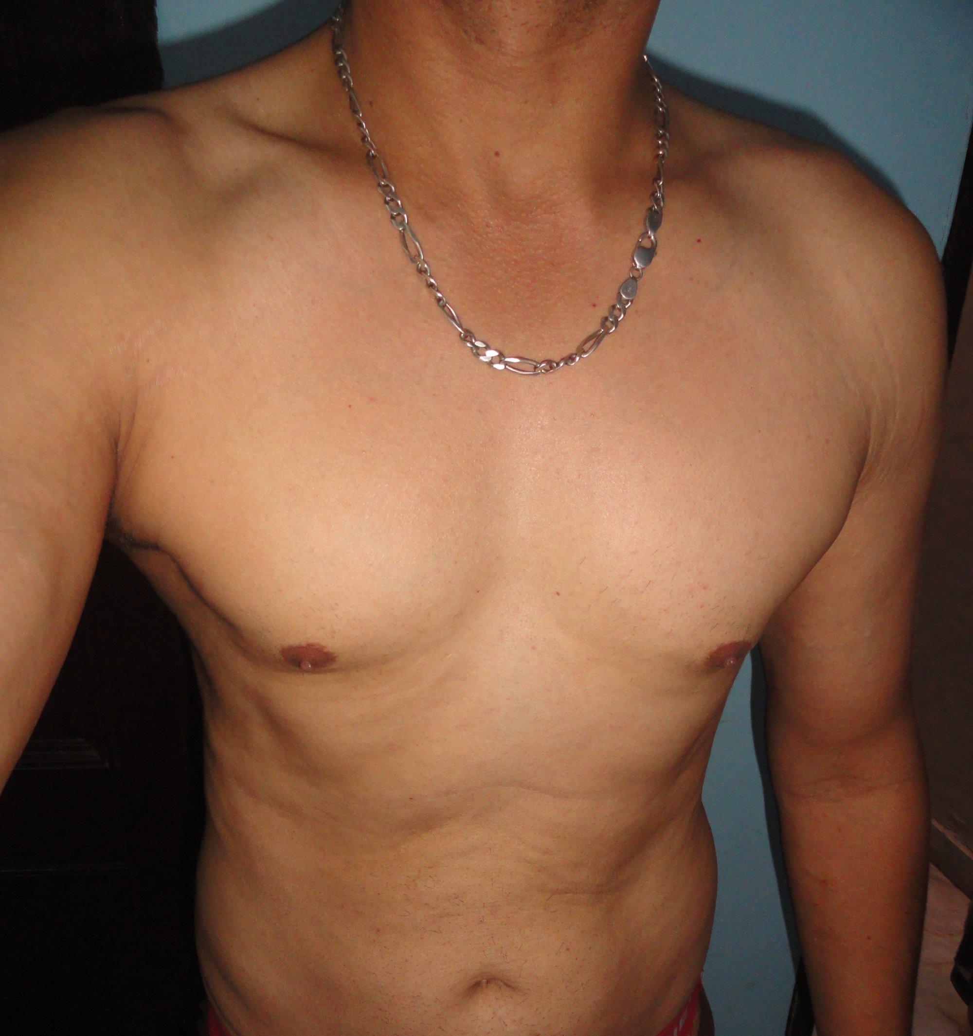 roxym