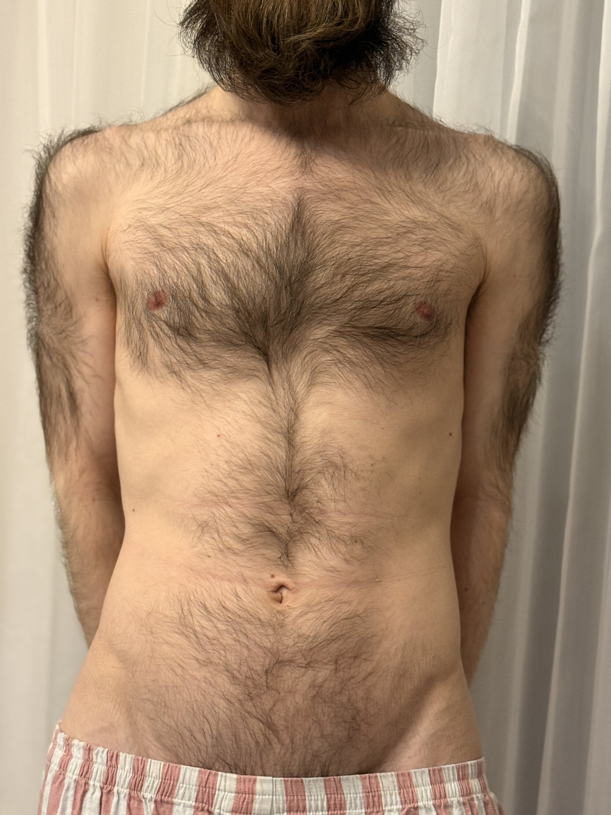 hairybaldboy1