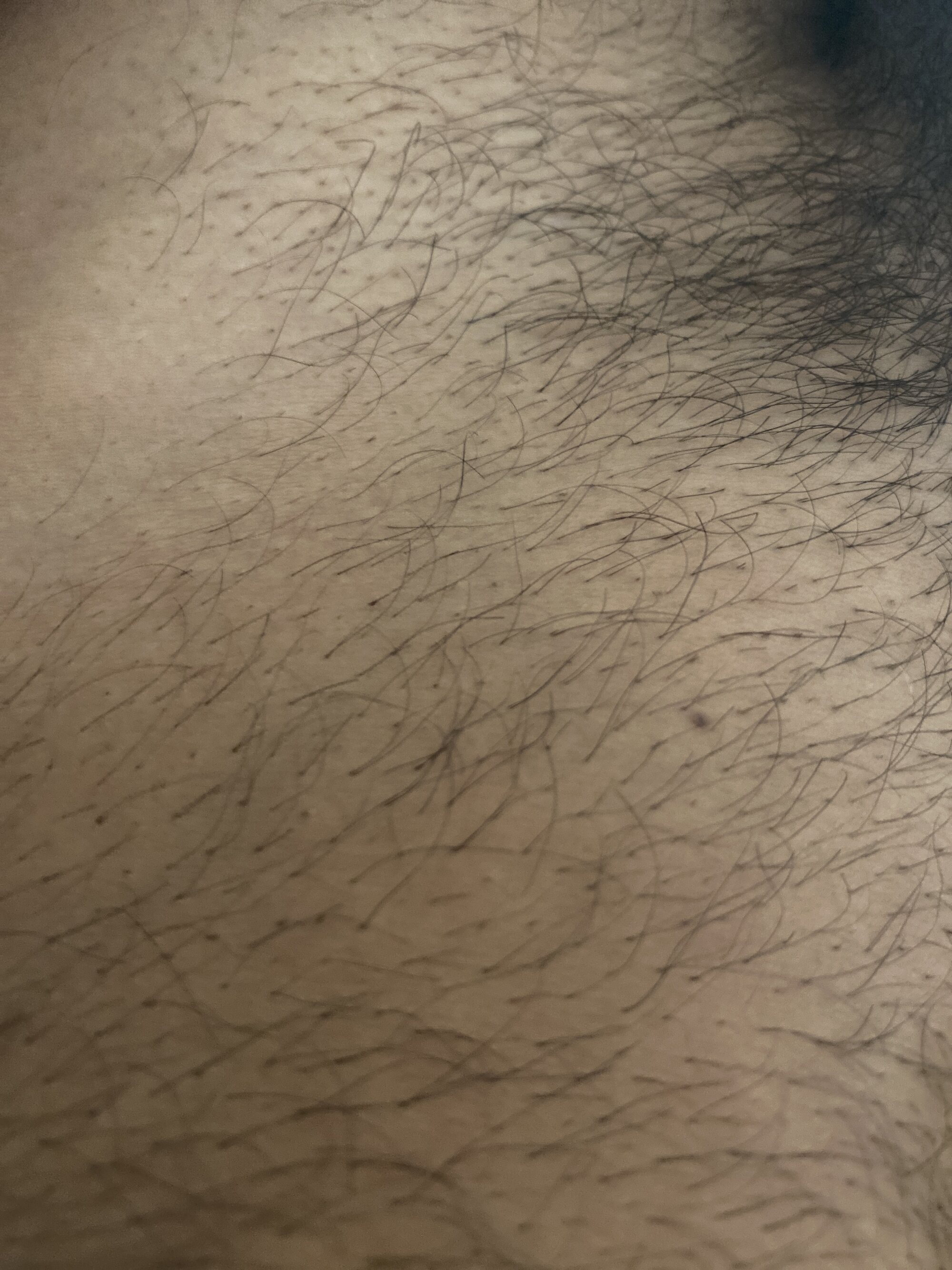 disporeelgrossebite