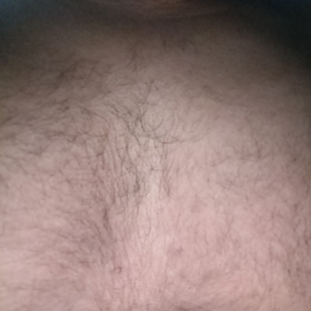 hairy-guy1