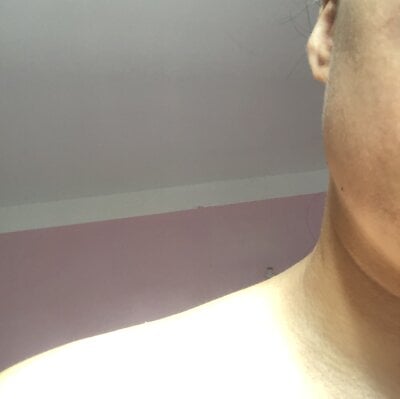 Adxi2