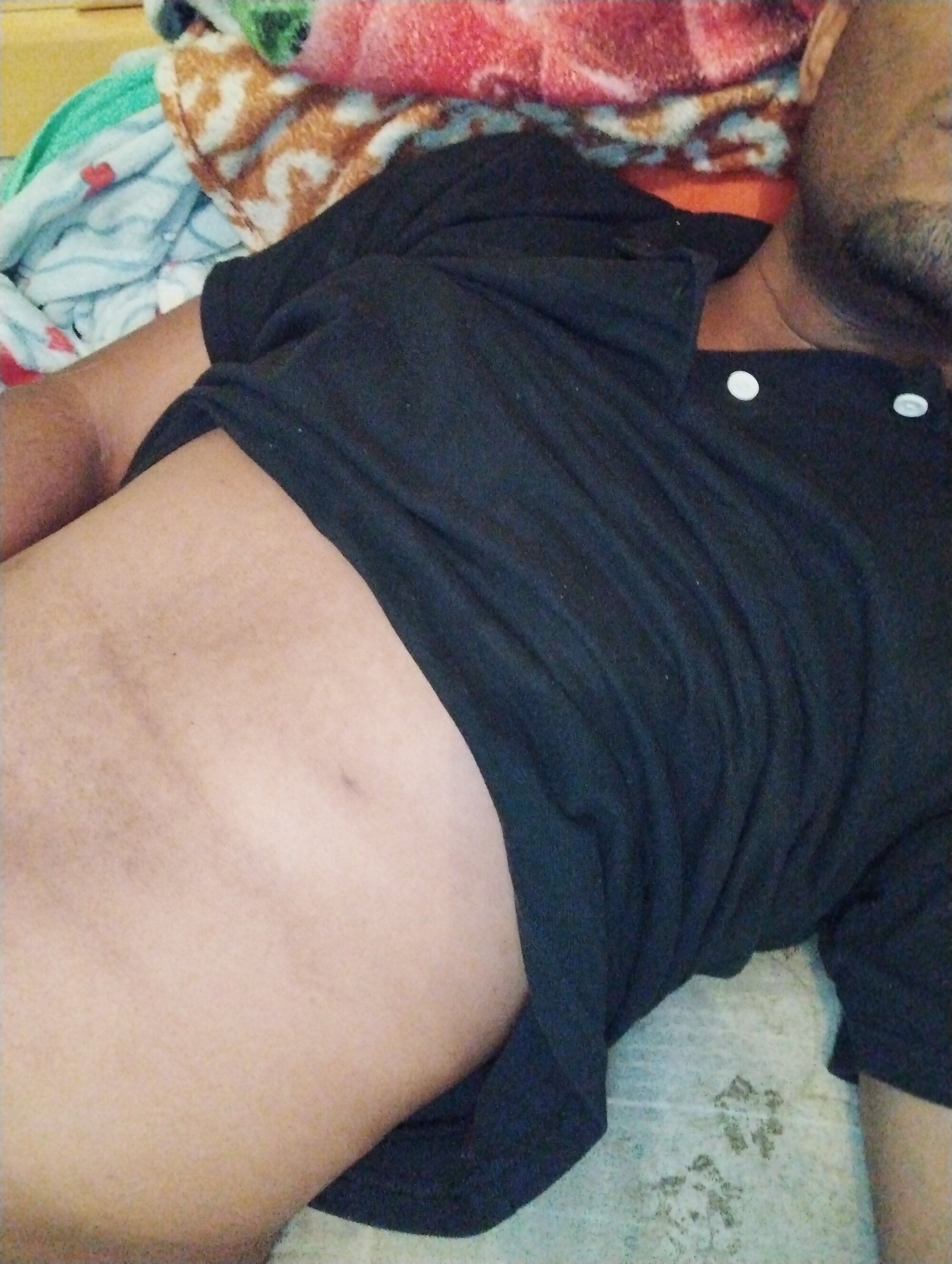 calrlho