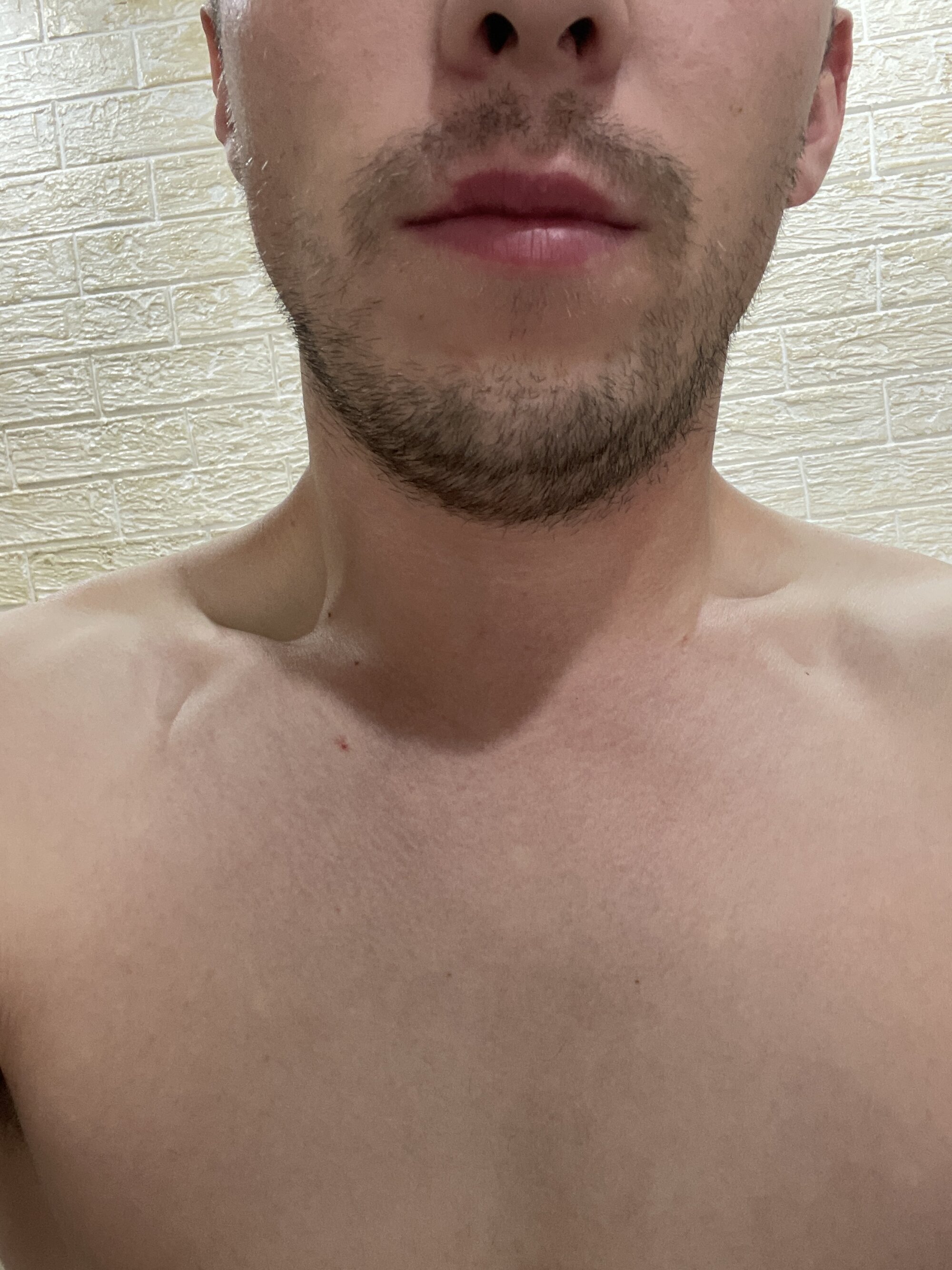 BillyXSmile