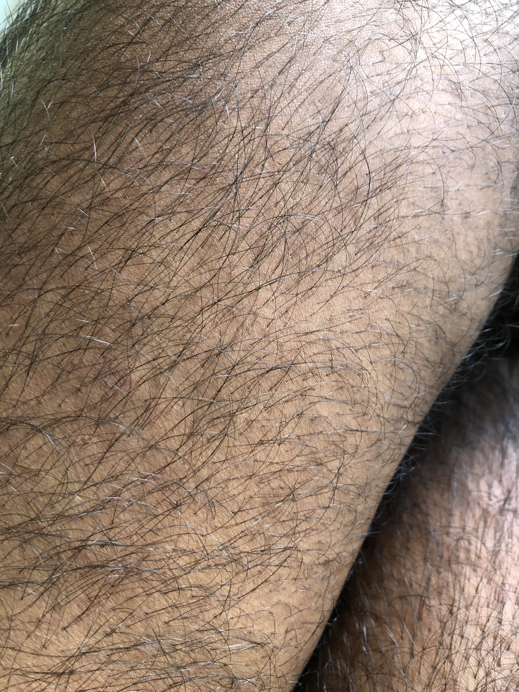 Hairy_dick6
