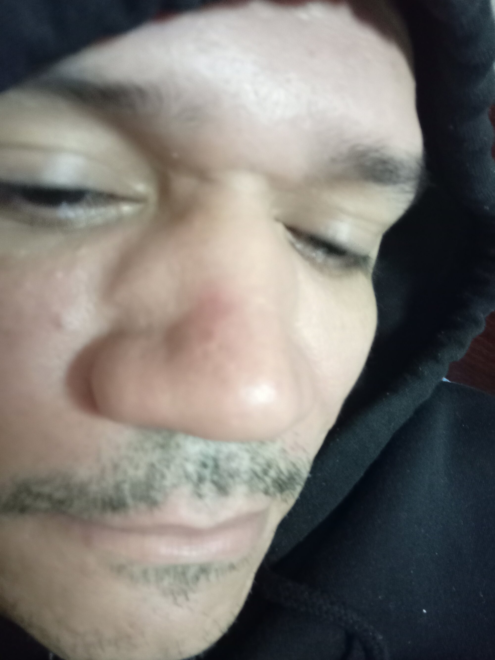 chupau