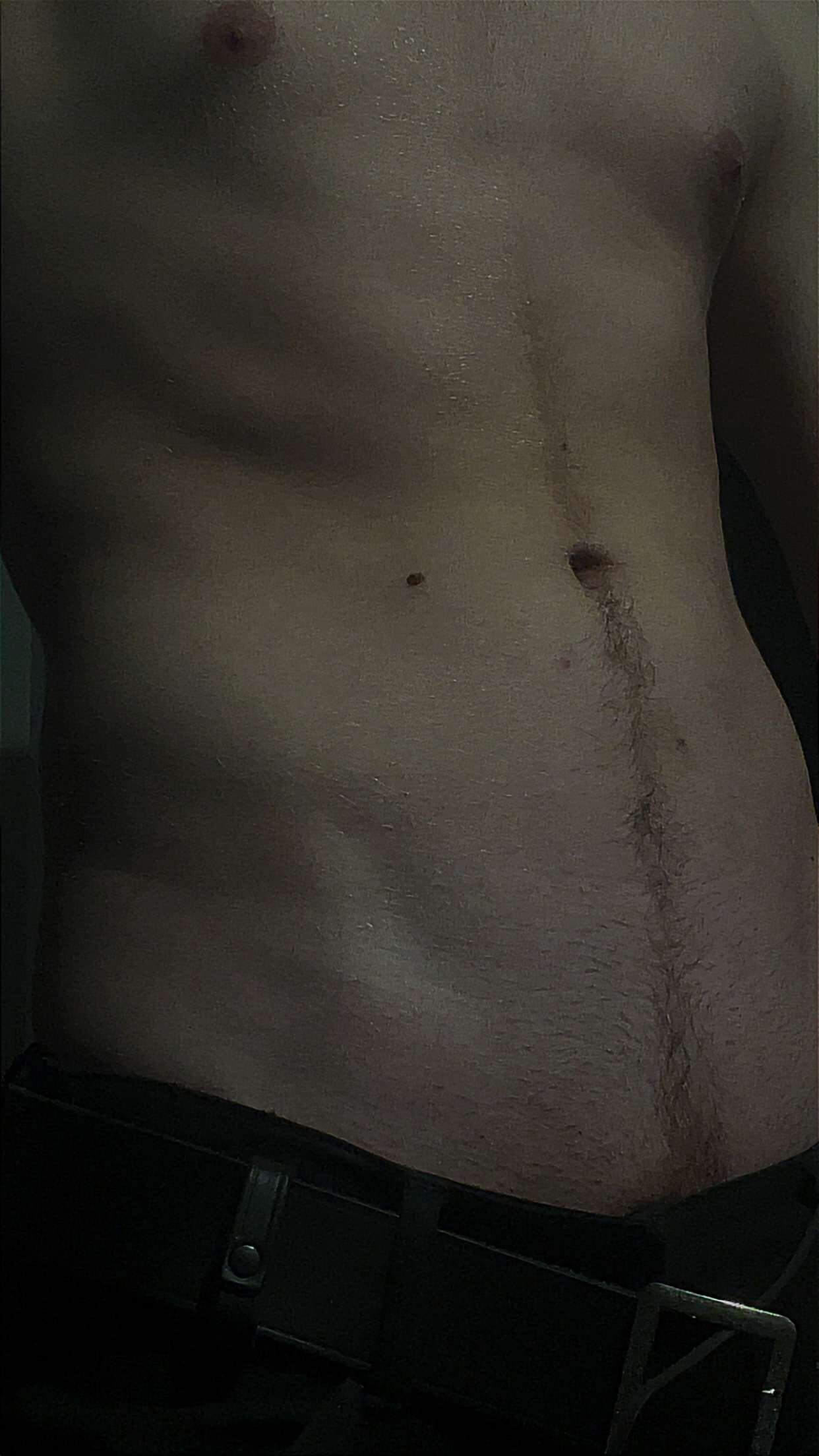 baretwinky