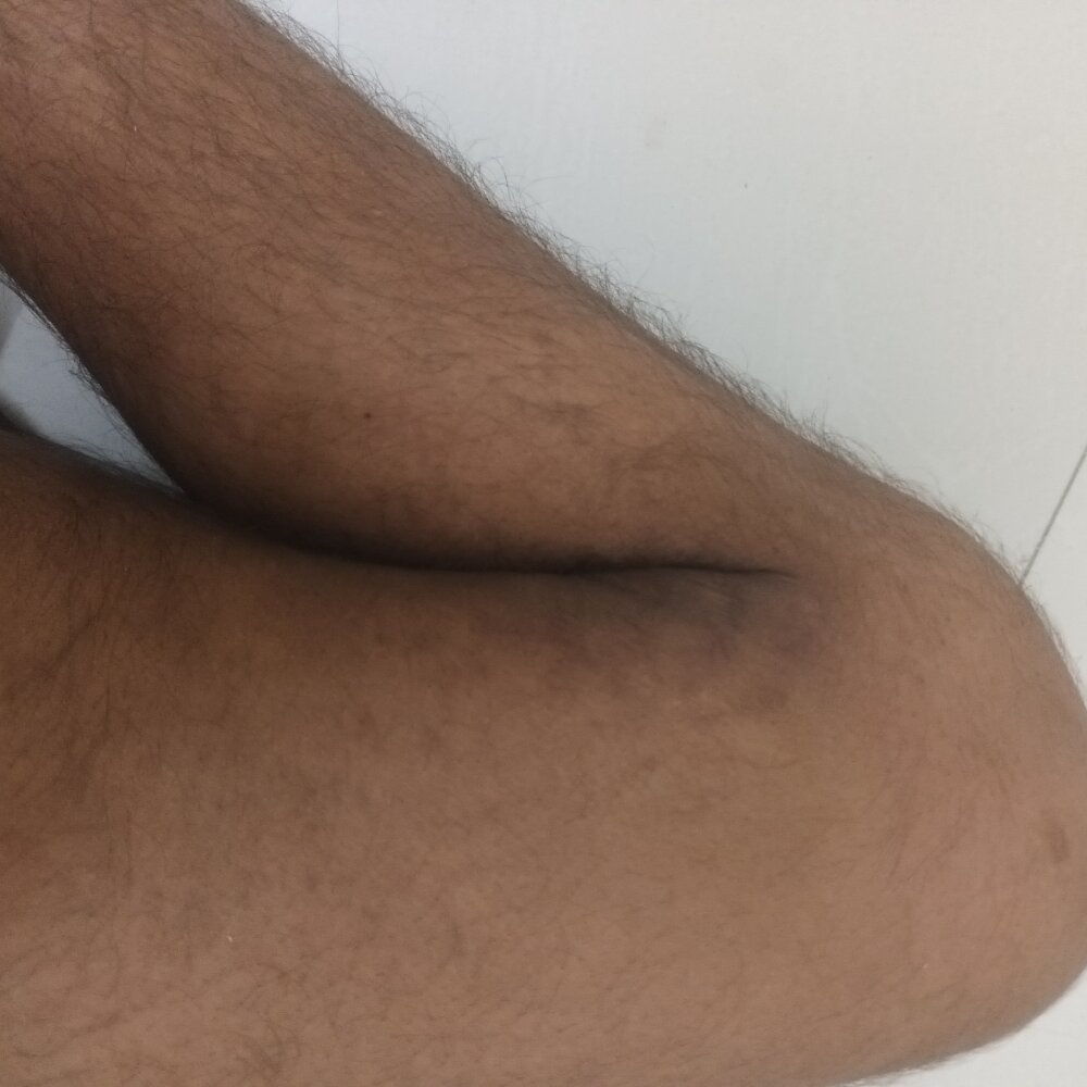 Aman938631