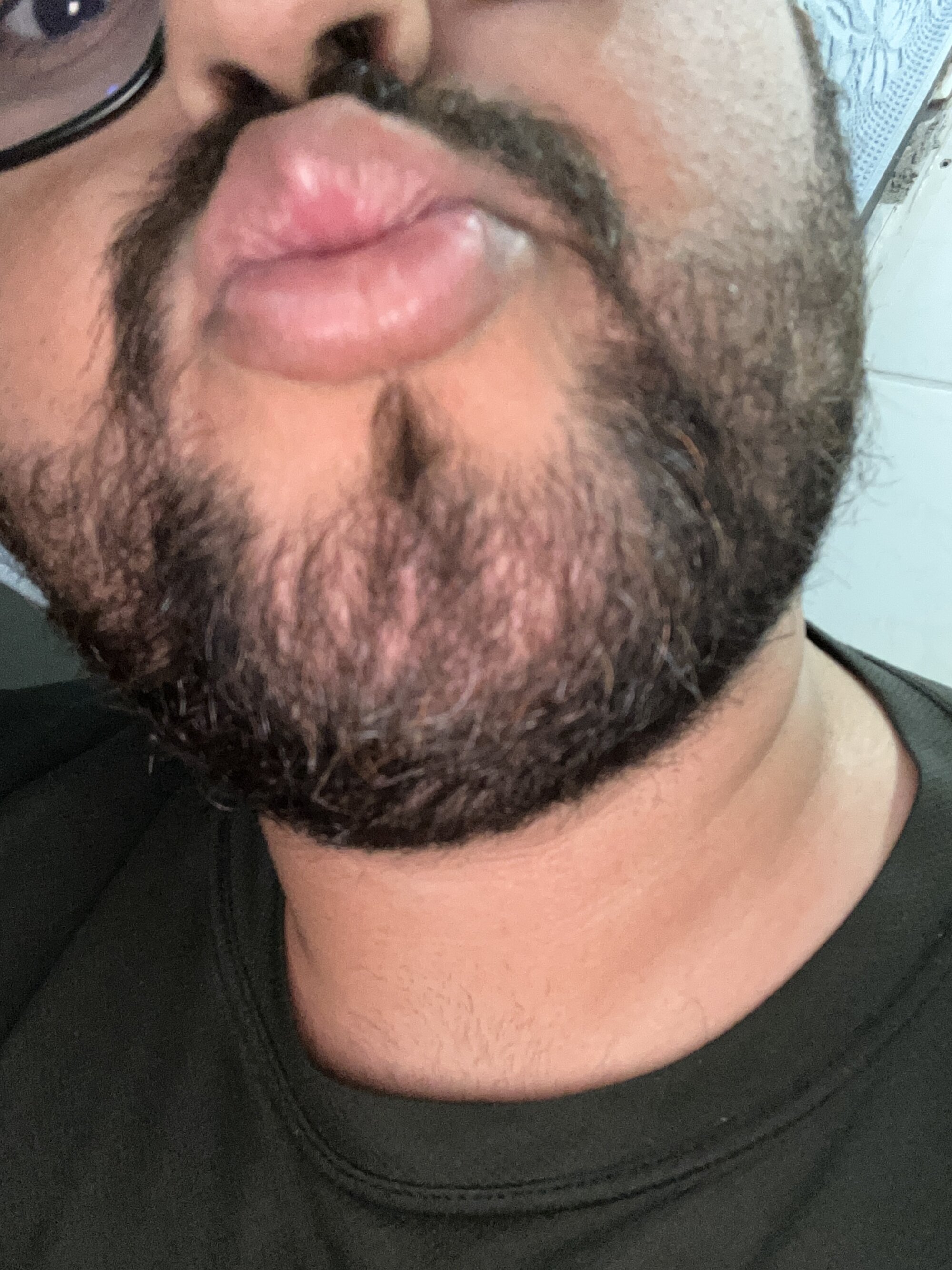 Heroslima38