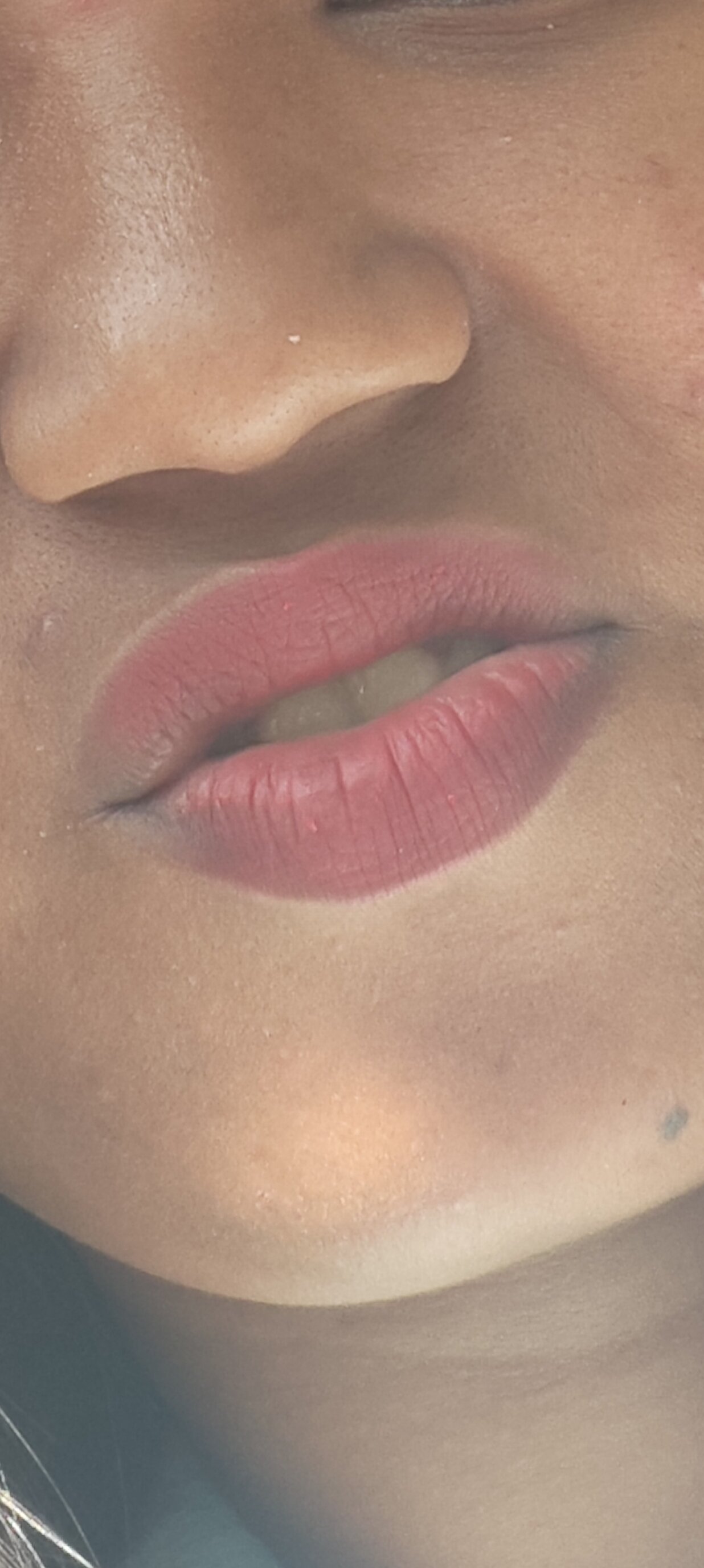 rupa003