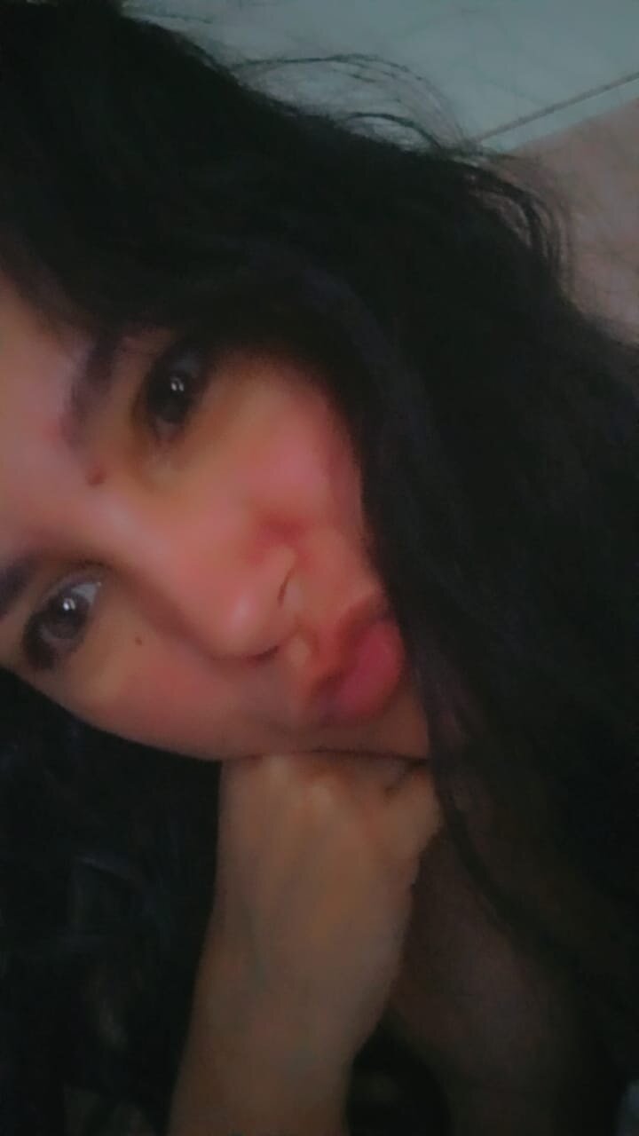 __Annye_