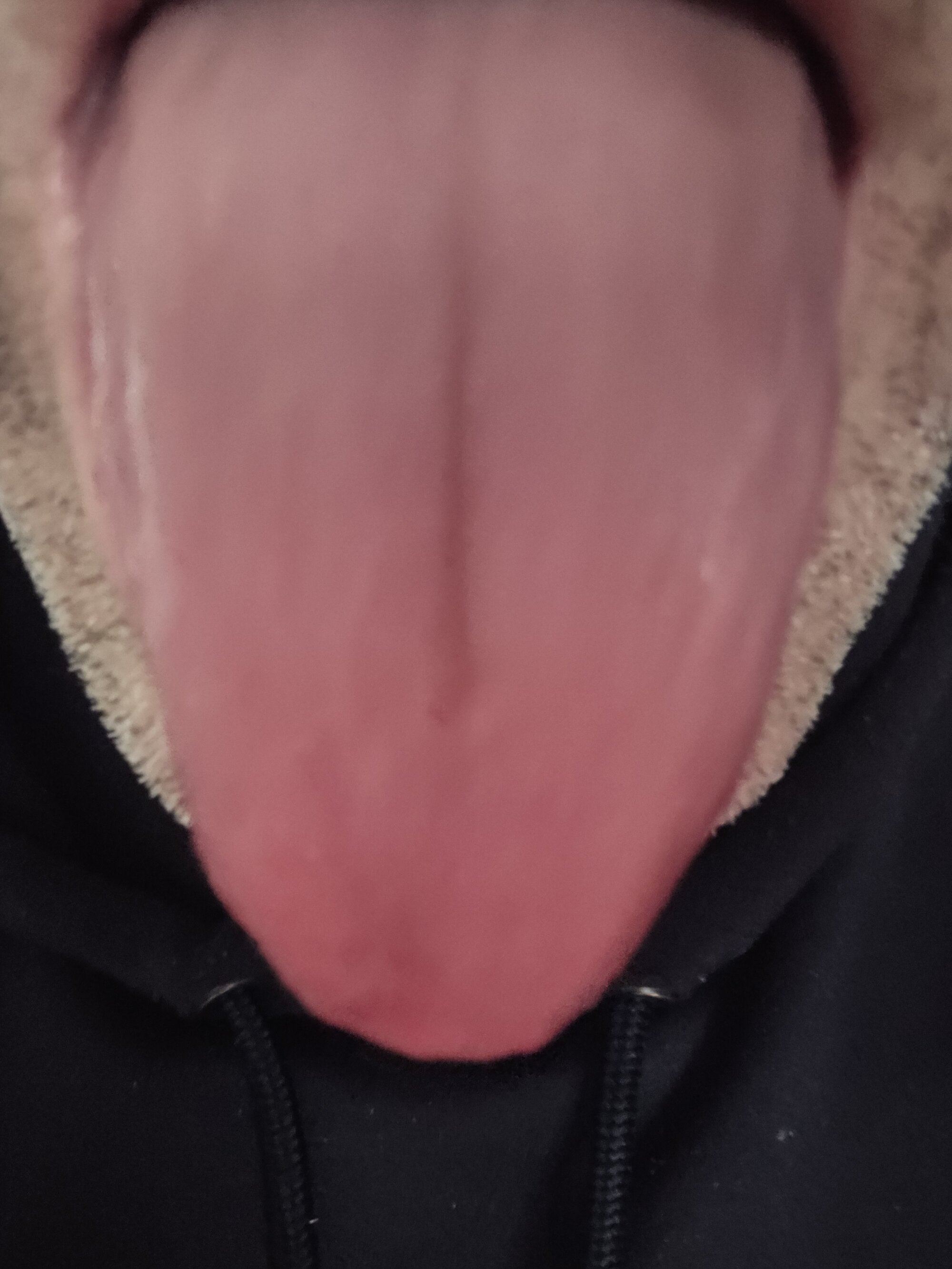 naugthyxlive