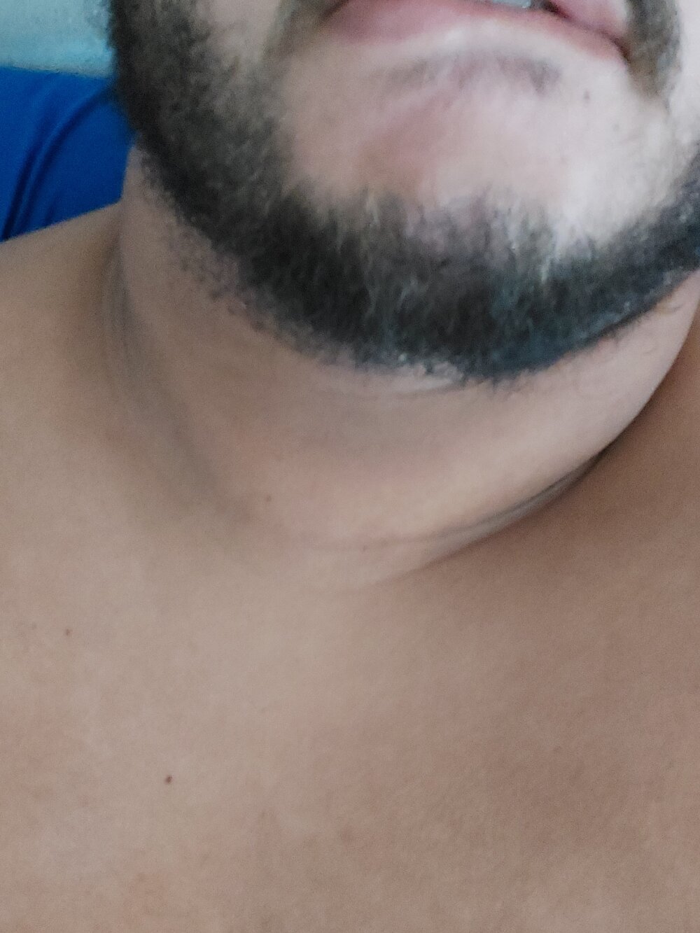 ursopeitudo01